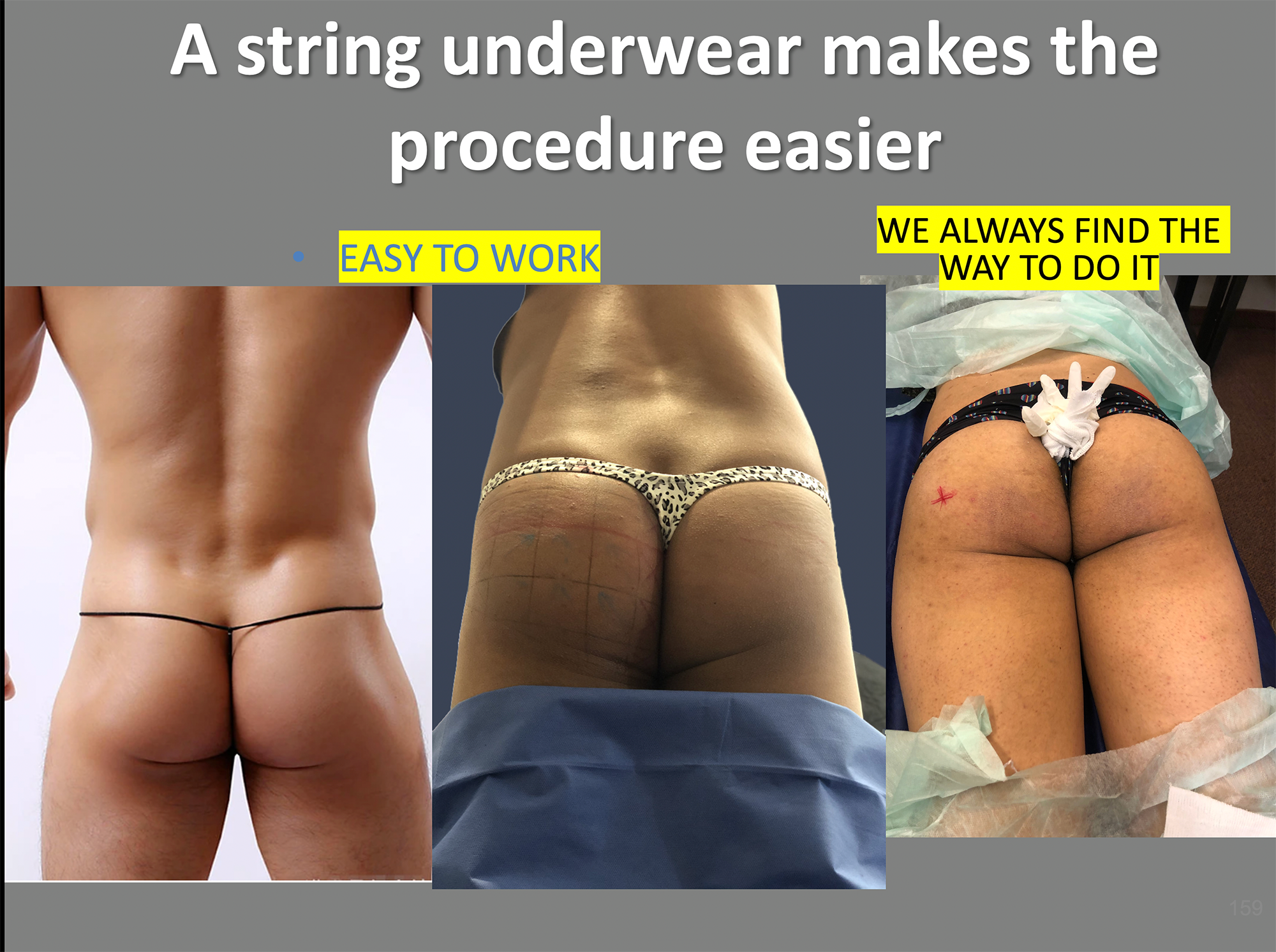 conclusion-endopeel-underwear