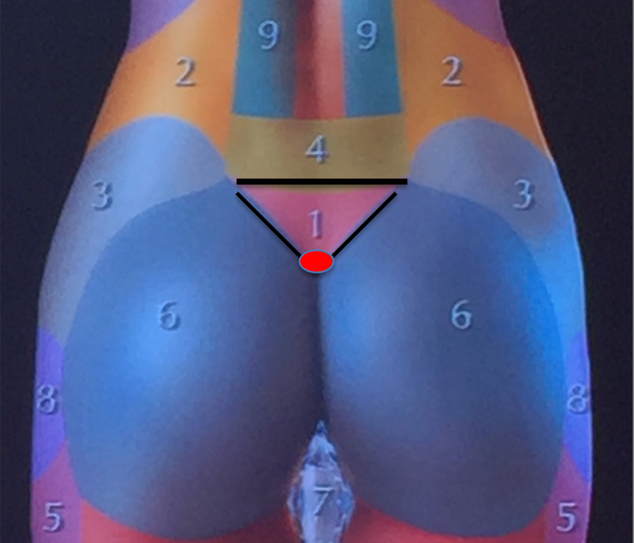 pre sacral triangle in theory