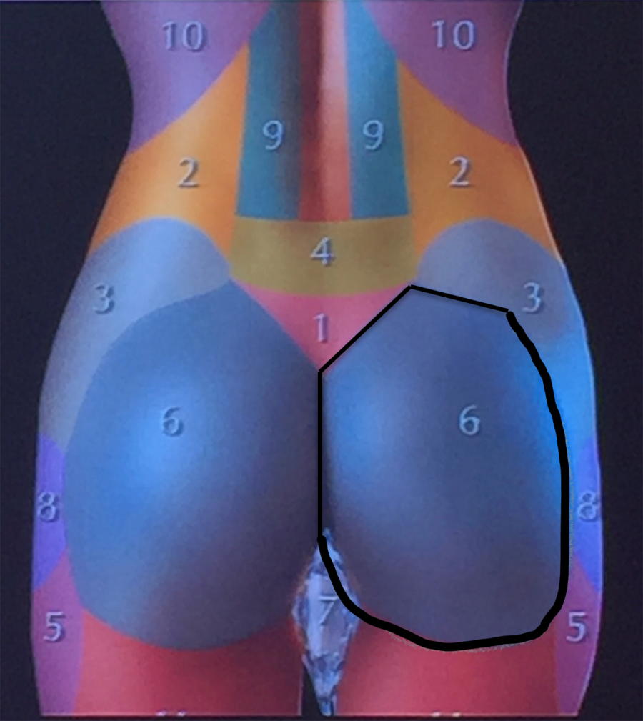 gluteal-area-limits-by-theory