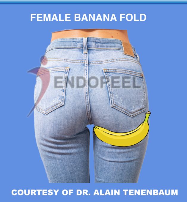 female-banana-fold