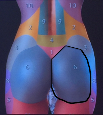 gluteal area limits theory