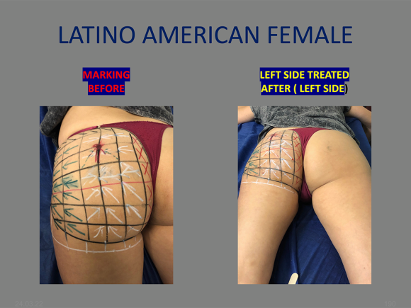 latino-female-butt