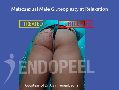 metrosexual men/relaxation