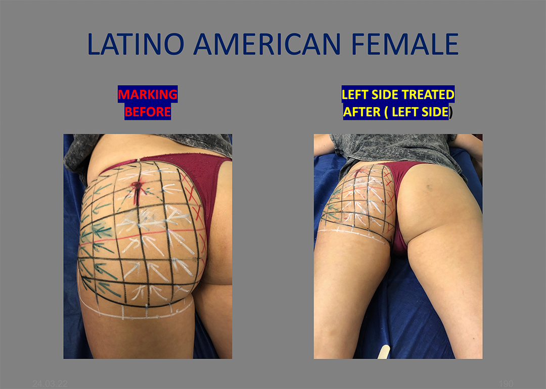 latino female butt