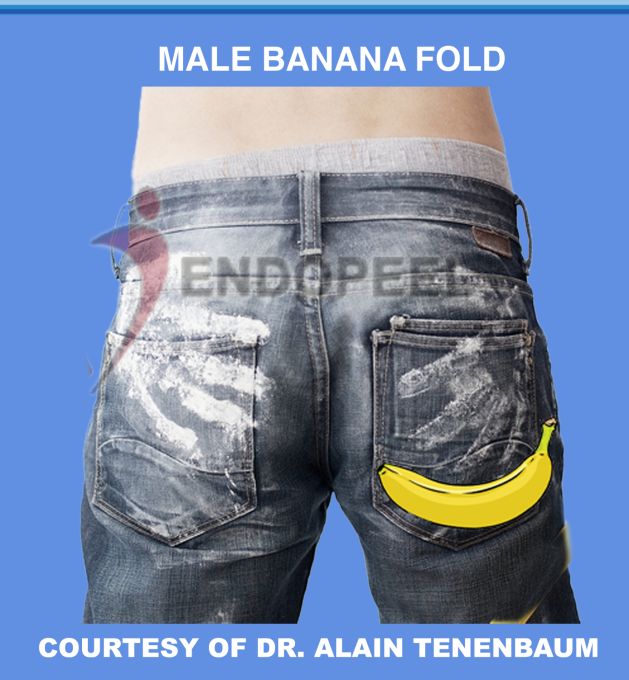 male-banana-fold