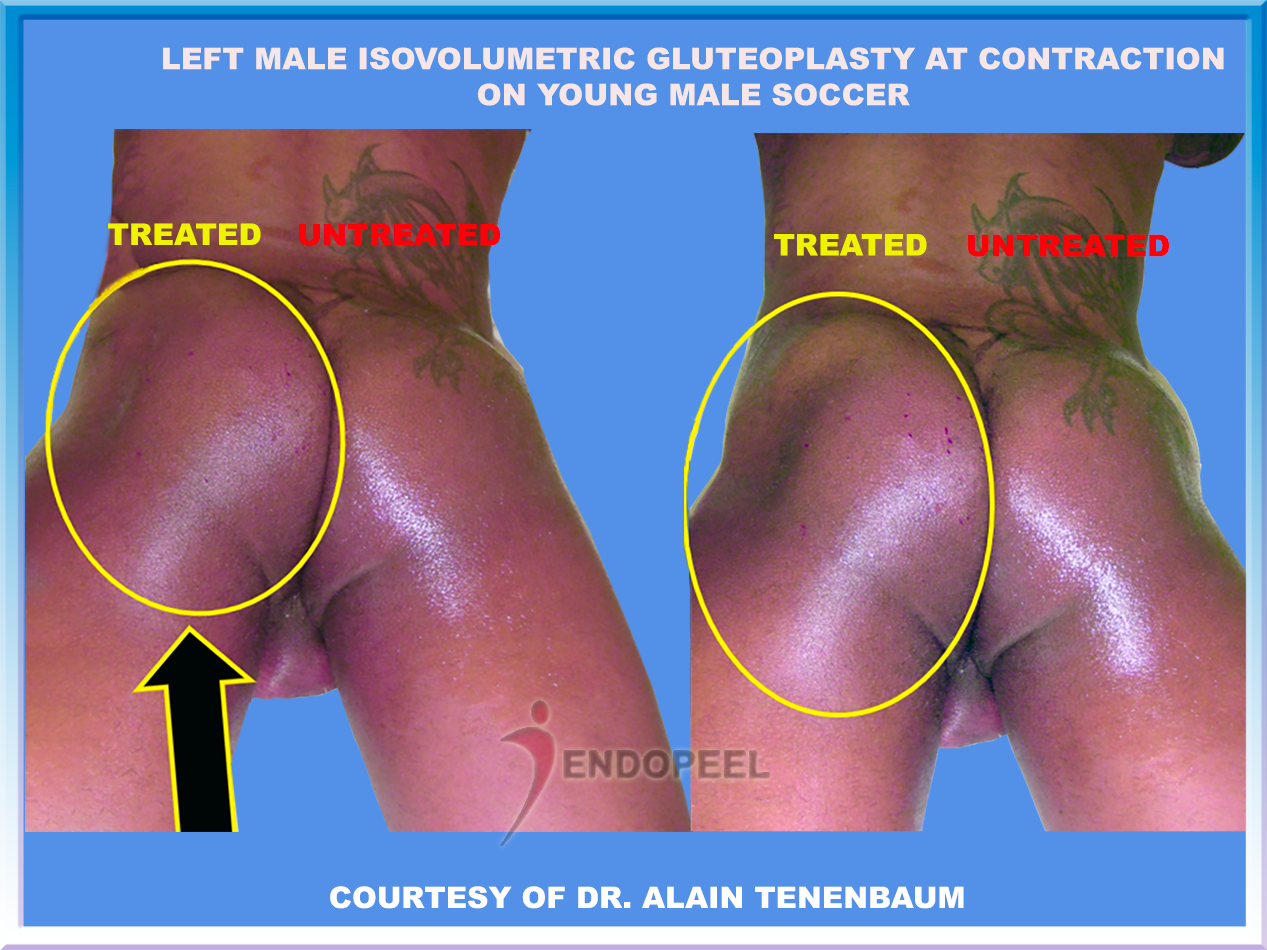 L sporty male butt at contraction
