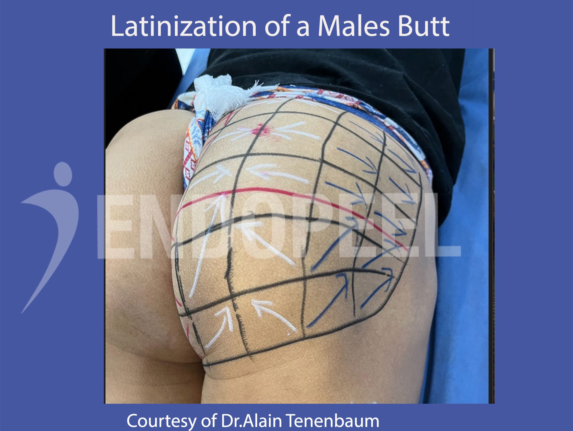 latinization-tensors-for-males-butt.